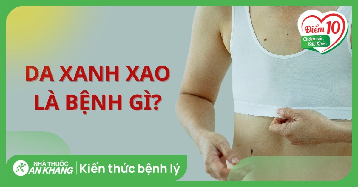 Xanh Sao Hay Xanh Xao? Gallery 2