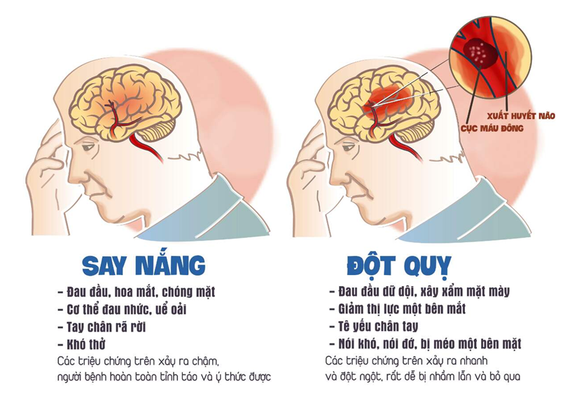 Xay xẩm là gì? Nguyên nhân, triệu chứng và cách xử trí