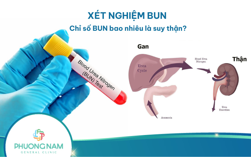 Xét nghiệm BUN là gì? Gallery 2
