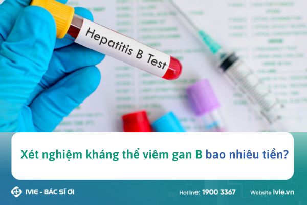 Xét nghiệm kháng thể viêm gan B bao nhiêu tiền? Gallery 2