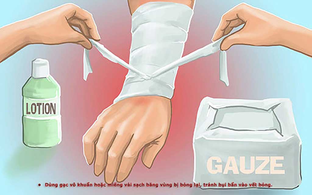 Thuốc Trị Bỏng Nước Sôi Hiệu Quả Và An Toàn Gallery 1