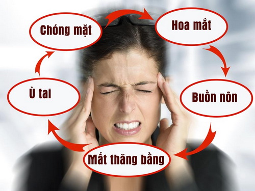 Choáng đầu nên làm gì? Gallery 2