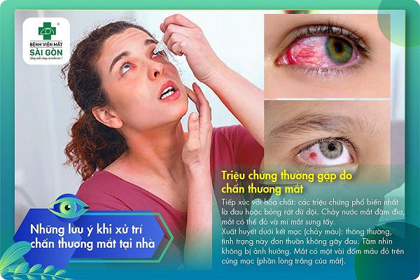 Bị vật nhọn chọc vào mắt: Cấp cứu và phòng ngừa Gallery 1