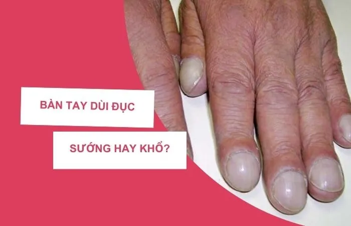 Bàn Tay Dùi Đục Là Gì? Nguồn Gốc, Ý Nghĩa Và Cách Sử Dụng Gallery 2