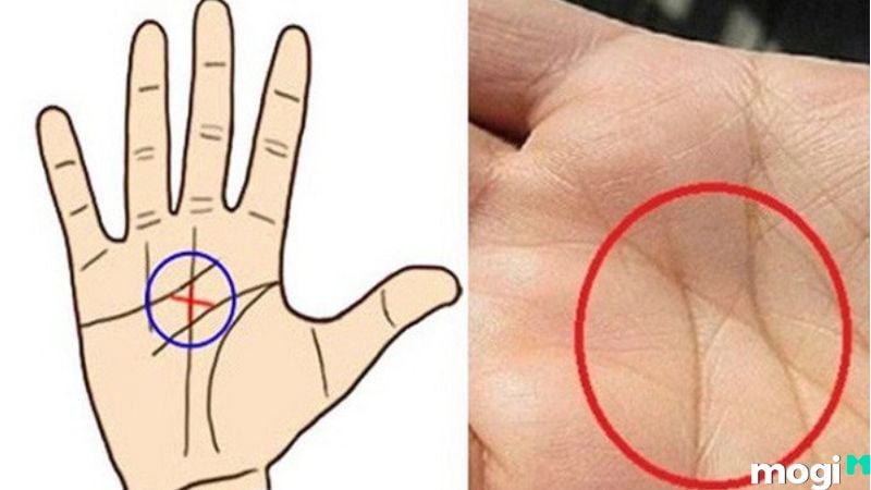Lòng bàn tay có dấu X: Ý nghĩa và giải đáp Gallery 1