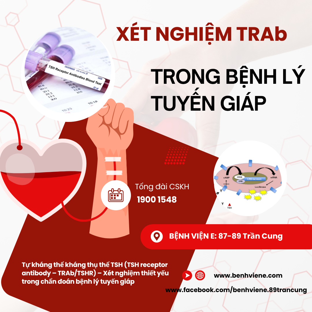 Định lượng TRAB là gì? Gallery 2