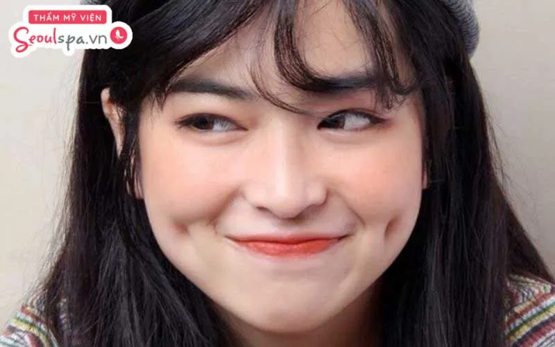 Con gái có má lúm đồng tiền bên trái Gallery 1