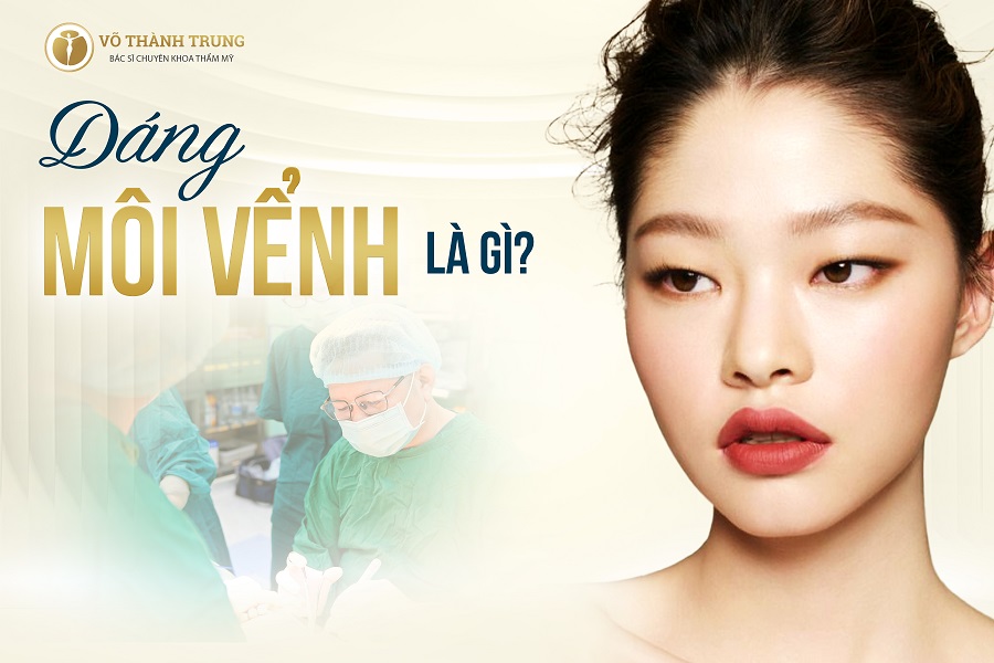 Môi Vểnh Là Gì? Gallery 2