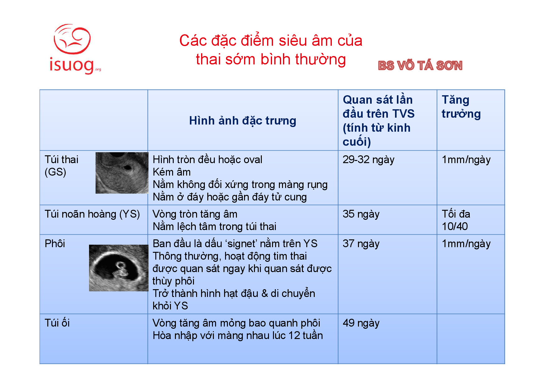 Túi Thai Bờ Đều Là Gì? Gallery 2