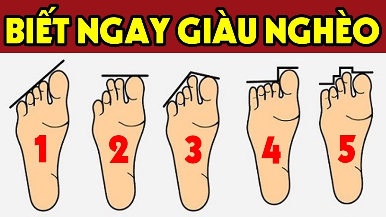 Ngón Trỏ Chân Dài Hơn Ngón Cái: Nguyên Nhân và Ý Nghĩa Gallery 2