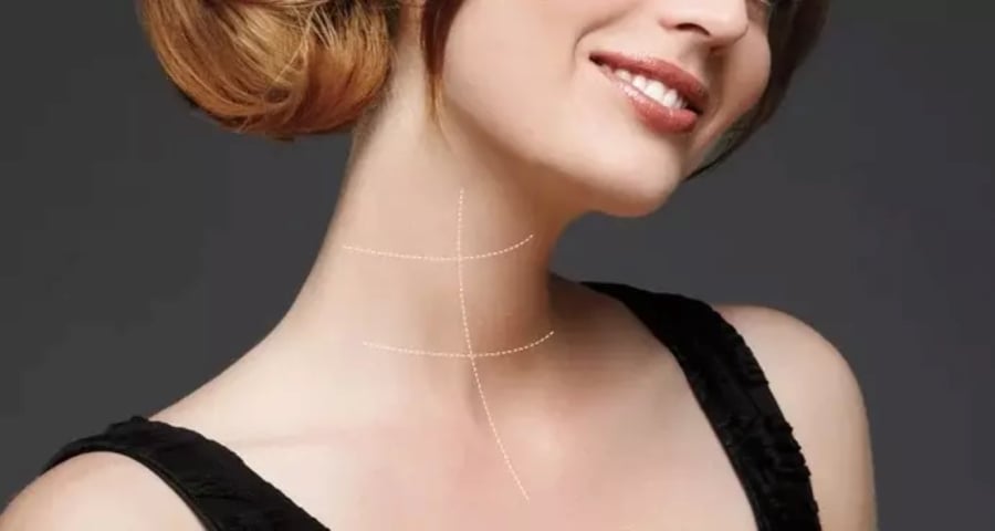 Cổ 3 Ngấn Nói Lên Điều Gì? Gallery 1