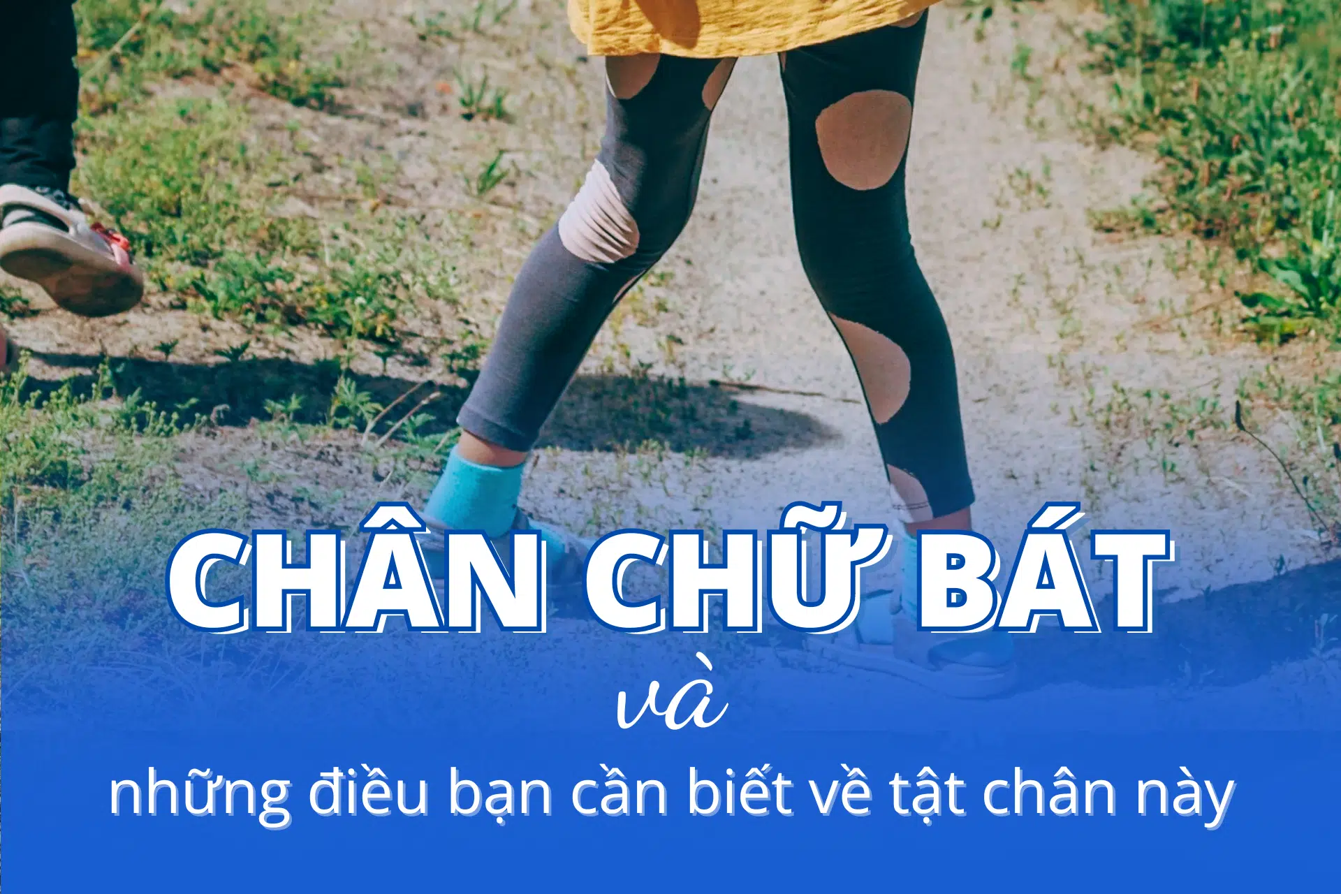 Tướng Phụ Nữ Chân Đi Chữ Bát Gallery 1