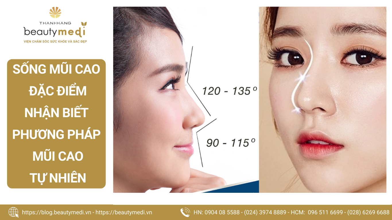 Vuốt mũi bao lâu thì cao? Gallery 1