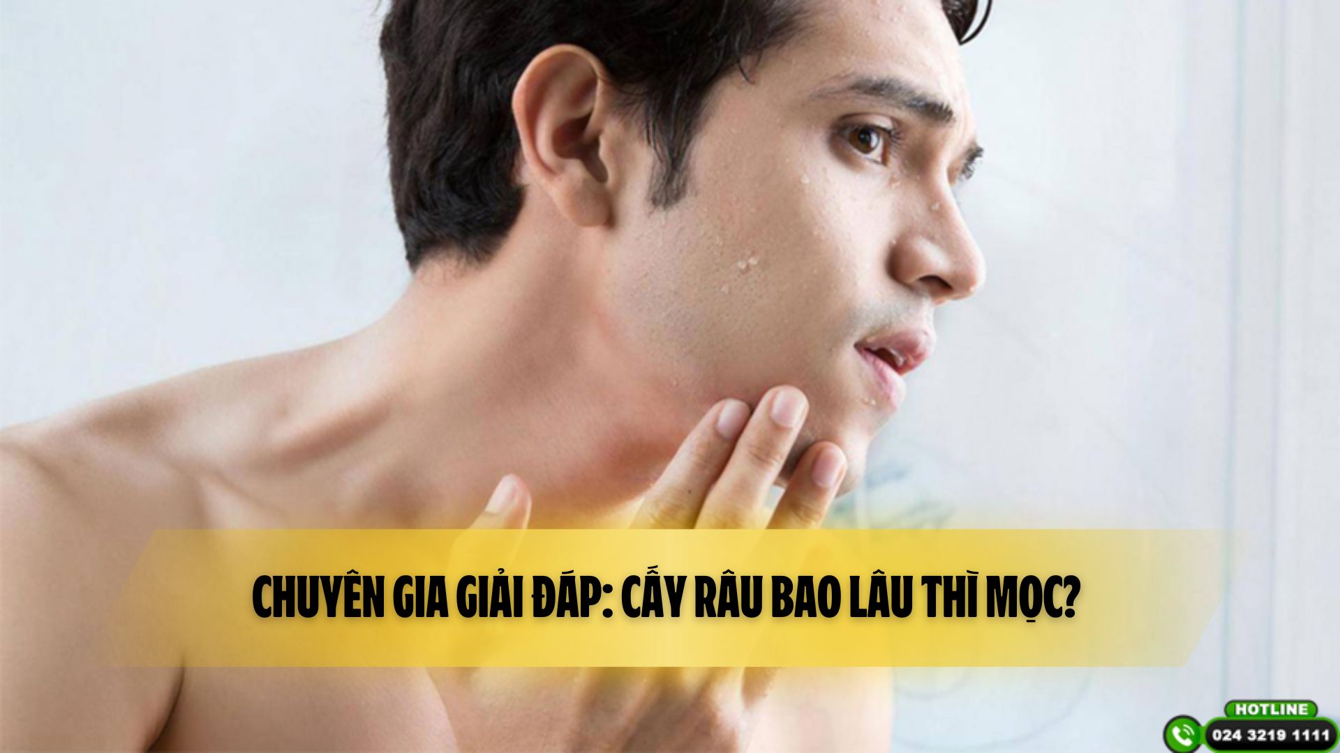 Cách Làm Râu Lâu Mọc Gallery 1