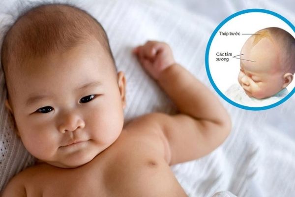 Trẻ đóng thóp khi nào? Gallery 1
