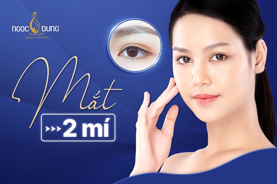 Mắt 2 mí đẹp hay xấu? Gallery 1