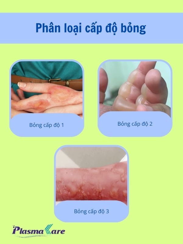 Bỏng cấp độ 2 có để lại sẹo không? Gallery 2