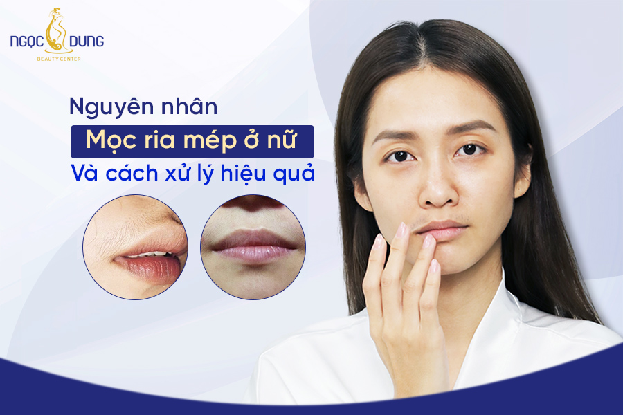 Tại Sao Con Gái Lại Có Ria Mép? Gallery 1