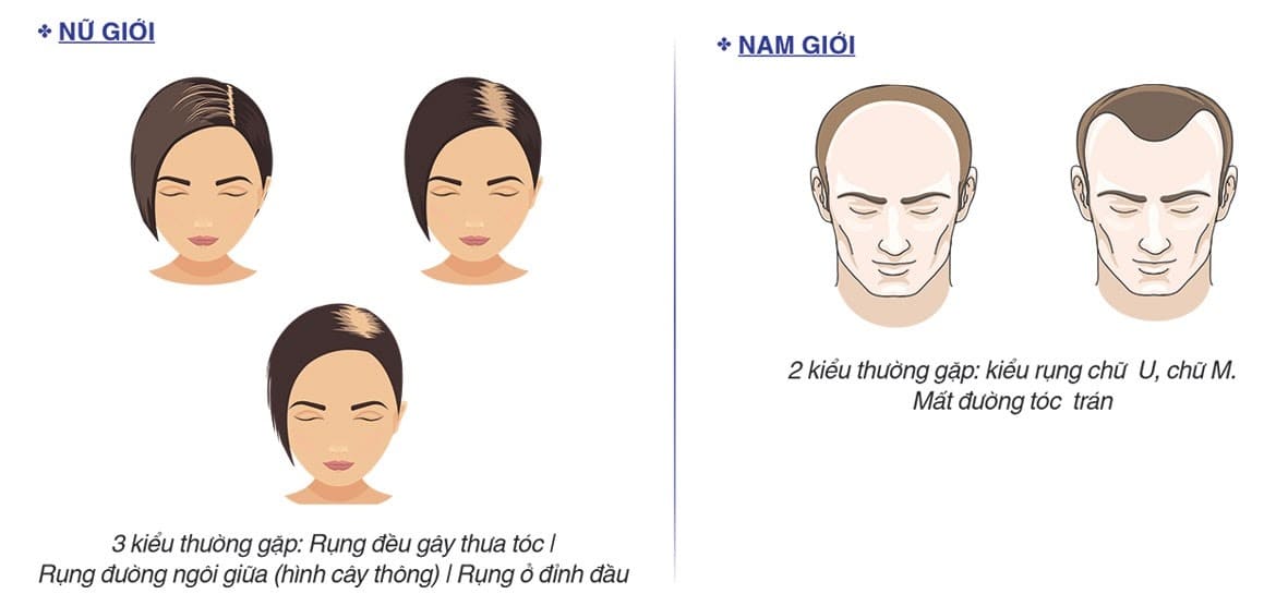 Tại Sao Tóc Mọc Chậm? Gallery 1