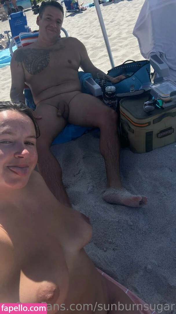 sunburnsugar Onlyfans Photo Gallery 