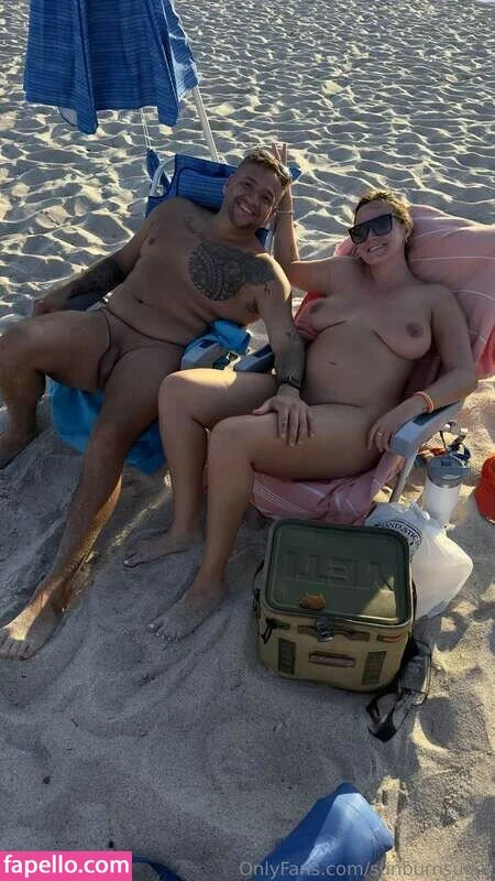 sunburnsugar Onlyfans Photo Gallery 