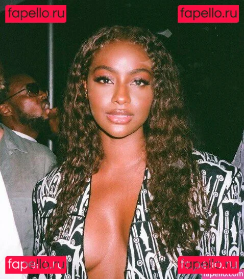 Justine Skye Onlyfans Photo Gallery 