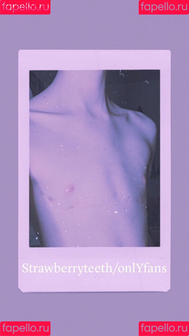 strawberryteeth Onlyfans Photo Gallery 