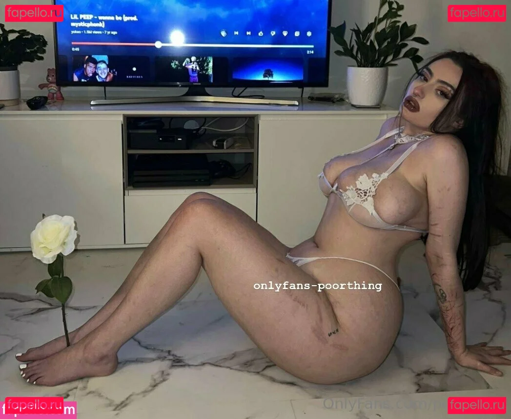 poorthing Onlyfans Photo Gallery 