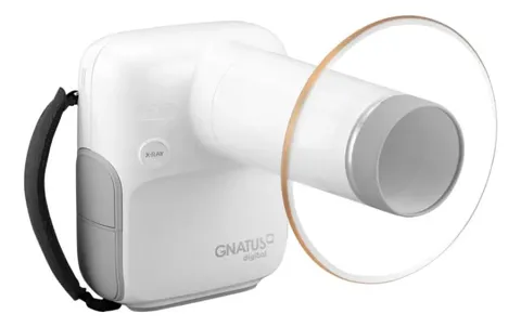 Raio-X Odontológico Portátil Timex Port-X IV - Gnatus