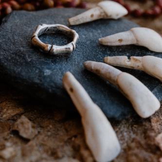 Bone ring