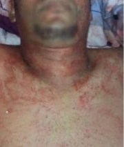 cebola-morto-2