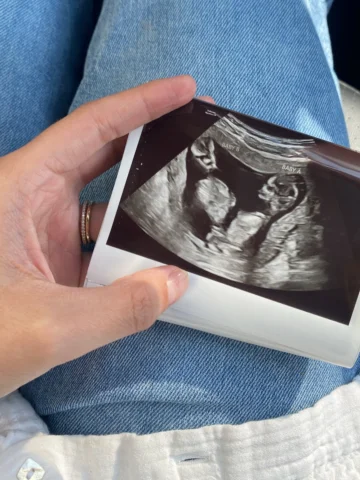 How has it almost been 9 months? 9 months since we last held you both in our arm