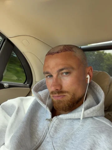 I didn’t call you baldy