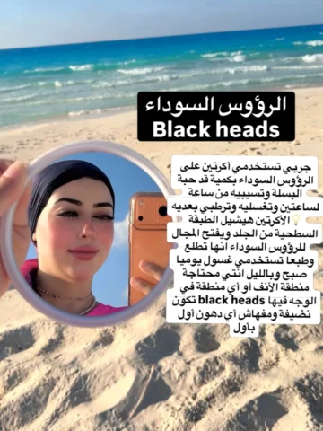 لو عندك في بشرتك Black heads رؤوس سوداء متقلقيش ليها حل !
دي بتكون نتيجة تجمع ال