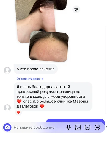 Каждый день получаем сотни хороших отзывов 🤗.
Лечим зарубежными методиками.
Воз