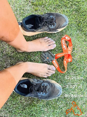 As marcas da batalha ⚔️🏃🏼‍♀️🔥

Esse são meus pés depois de correr quase 53 km
