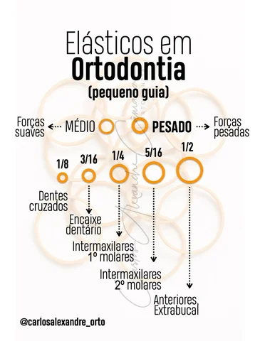 Elásticos em ortodontia são ferramentas sensacionais que, muitas vezes, fazem a 