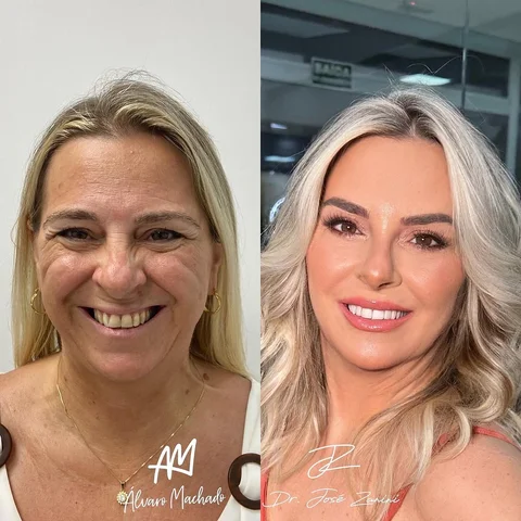 REJUVENESCIMENTO FACIAL
É muito mais do que um procedimento é sobre mudança de v