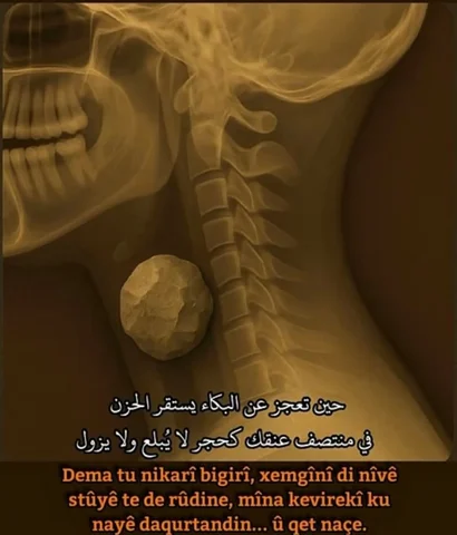 💔! ... 
. 
.. 
. 
ل.