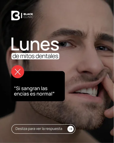 🖤 Lunes de mitos dentales

“Si sangran las encías es normal” ❌

La verdad es qu