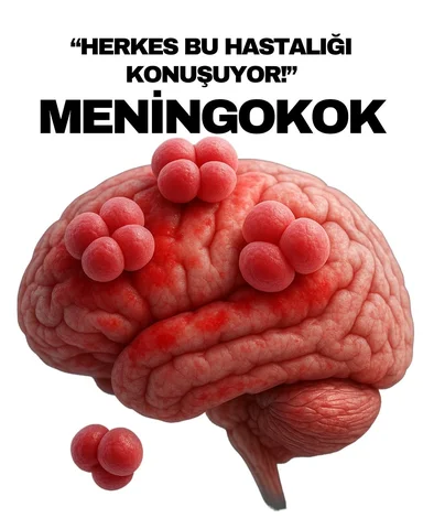 İngiltere’de meningokok hastalığının yeniden konuşulmasıyla bu konuyla ilgili da