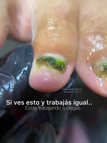 👀⚠️👉🏻Nadie lo quiere decir, pero alguien lo tiene que decir:

🤨La mayoría de