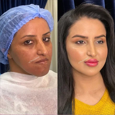 قصة اليوم تحقيق حلم فاطمة .. أمرأة كادحة تسعى لاجل قوتها اليومي ولم تنل الفرص با
