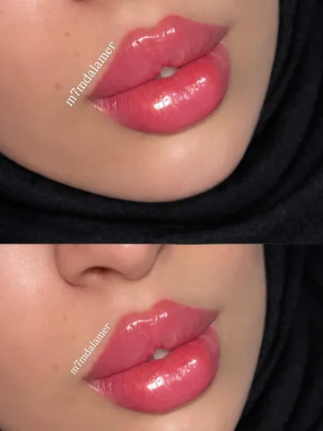 شفة العيد😍 عروض العيد 🌙⁨	⁨	🌙 
ابرة فلر تغير سباعي 200 الف بدل 250 الف 
ابرة ف