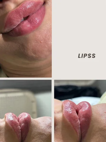 Lipss🫦✨