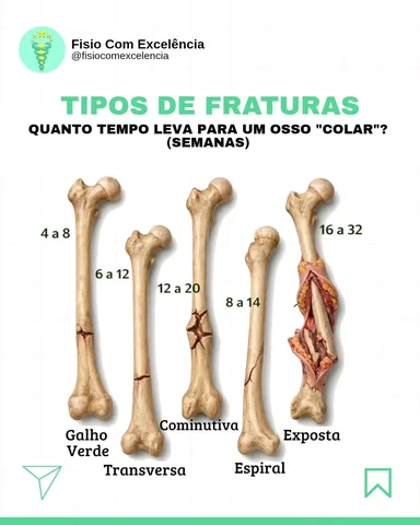 👉🏻 Siga @fisiocomexcelencia para mais conteúdos como esse.

Nem toda fratura é