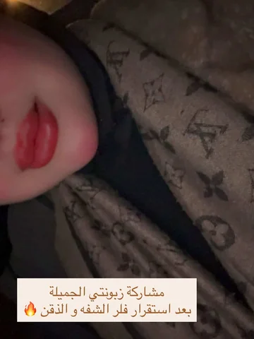 شكد حلوة النتيجة و البنيه 😍🔥
أعمال عيادة التجميل 👄🔥
رسمه شفه طبيعيه 🔥
#اكسب