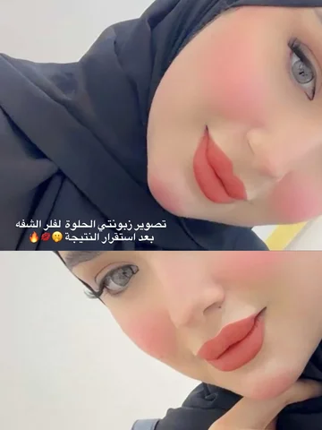 احب تصويركم و شلون كيكه هي تخبل زبونتي 😍🔥
أعمال عيادة التجميل 👄🔥
رسمه شفه بل