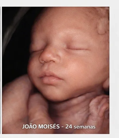 Ecografia 4D e 8D realizada pela clínica @clinicadiason 🥹
Meu Deus que coisa li