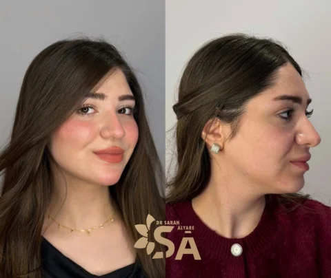 ١٠ ابر 
من وجه بي ذبول و نزول و وجنات خاسفة لــ وجه صحي طبيعي مرسوم بطريقة انثوي